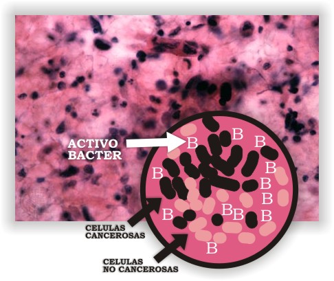 aumentobacter.jpg